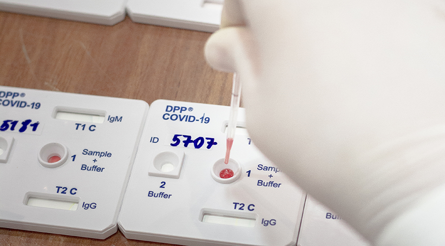 #PraCegoVer A foto mostra uma plaquinha branca de teste de COVID-19.
